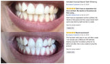 INSTANT Activated Teeth Whitening Kit: RRP £37.95 On Special OFFER! - Nur76