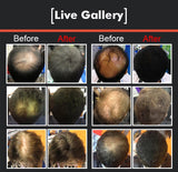 INSTANT Hair Grow, Building Fibres Black, Dark Brown Colour for Hair Loss, Baldness- AMAZING RESULTS! - Nur76